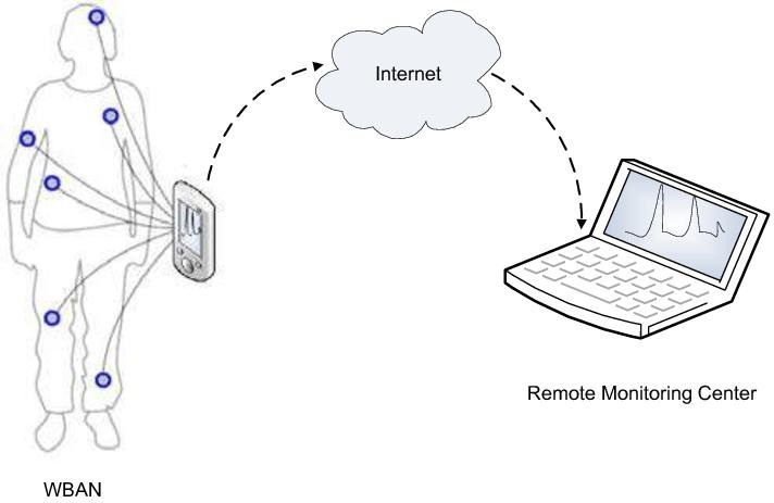 Body Area Network Market