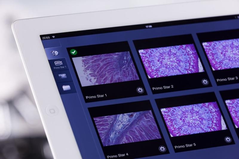 Microscope Software Market May See Big Move | Major Giants Andor