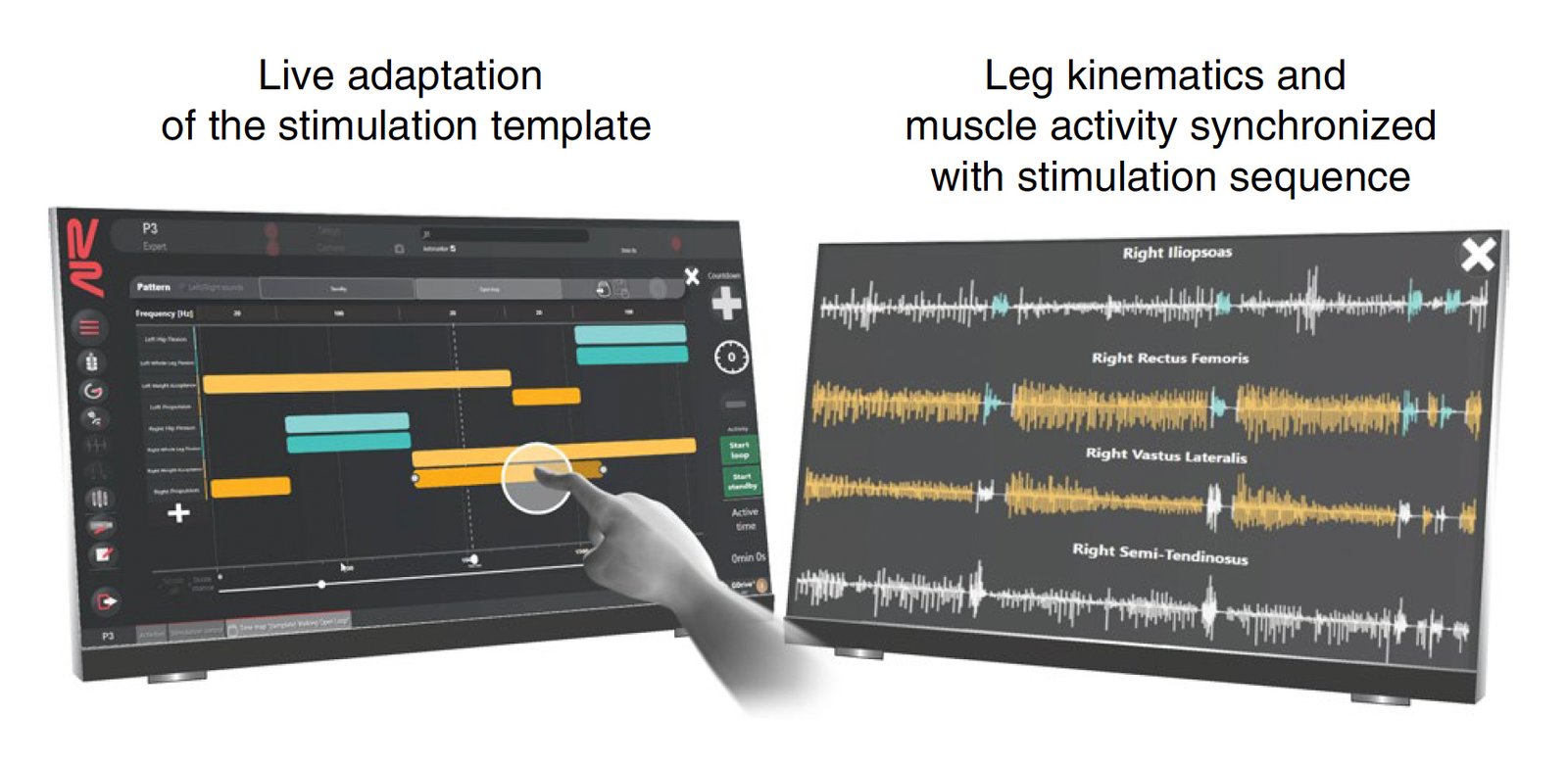 Patient's progress during Epidural Electrical Stimulation (EES) therapy, visualized with NeuroRestore powered by SciChart, showing walking stages and